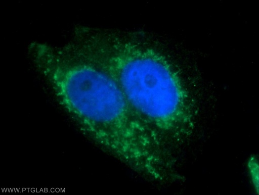 [15990-1-AP-20UL] BAAT Polyclonal antibody
