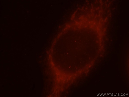 [15994-1-AP-20UL] CCT7 Polyclonal antibody