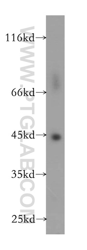 [16005-1-AP-150UL] GTF2H2 Polyclonal antibody