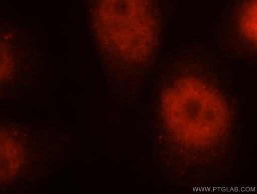 [16019-1-AP-20UL] DBR1 Polyclonal antibody