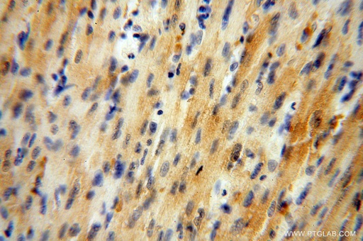[16022-1-AP-150UL] GALM Polyclonal antibody