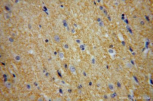 [16028-1-AP-150UL] MANBAL Polyclonal antibody