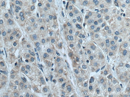 [16037-1-AP-20UL] NDUFB6 Polyclonal antibody