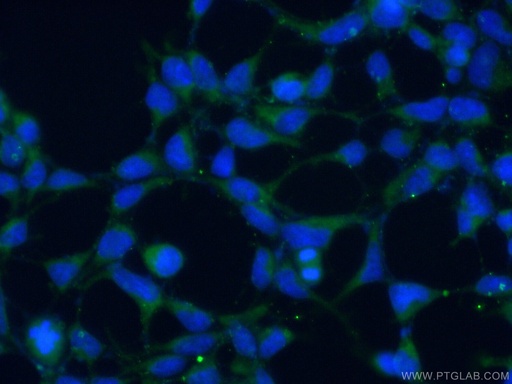 [16046-1-AP-20UL] ALG5 Polyclonal antibody
