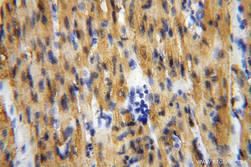 [16048-1-AP-20UL] Myoglobin Polyclonal antibody