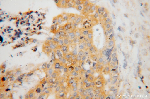 [16054-1-AP-20UL] ATP6V1C1 Polyclonal antibody