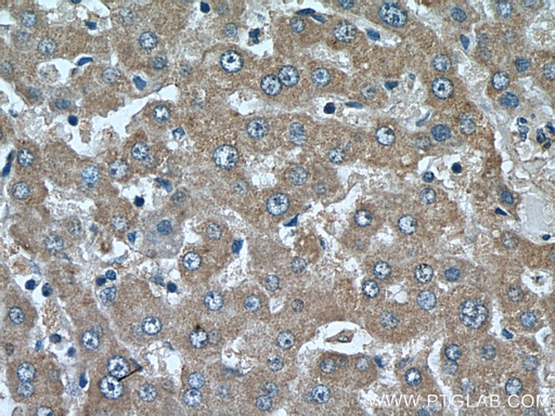 [16062-1-AP-20UL] CYP39A1 Polyclonal antibody