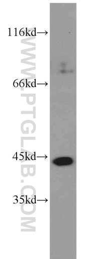 [16071-1-AP-150UL] PAK1IP1 Polyclonal antibody