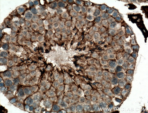[16077-1-AP-20UL] ACSBG1 Polyclonal antibody