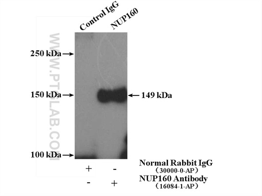 [16084-1-AP-150UL] NUP160 Polyclonal antibody
