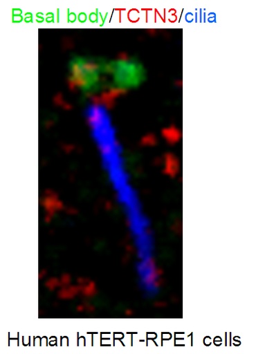 [16085-1-AP-150UL] TCTN3 Polyclonal antibody