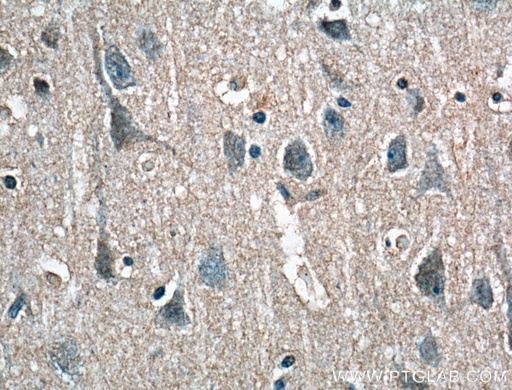 [16086-1-AP-20UL] RPL23 Polyclonal antibody