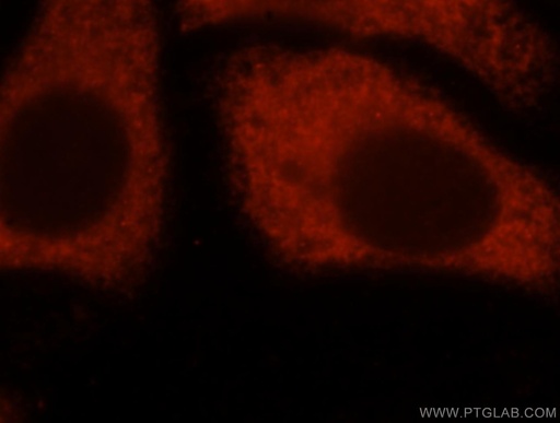 [16119-1-AP-20UL] EIF4A2 Polyclonal antibody