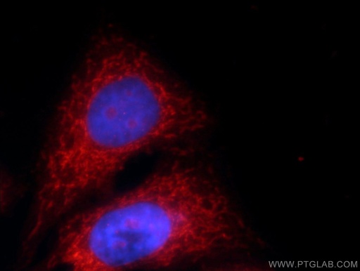 [16139-1-AP-20UL] MRPS18B Polyclonal antibody