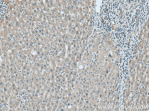 [16146-1-AP-20UL] LYPLAL1 Polyclonal antibody