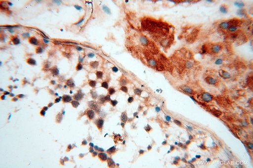 [16150-1-AP-20UL] BAG1S/1M/1L Polyclonal antibody