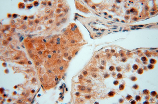 [16151-1-AP-150UL] SMYD1-Specific Polyclonal antibody