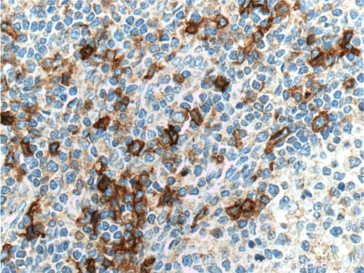 [16154-1-AP-20UL] CCR2b-specific Polyclonal antibody