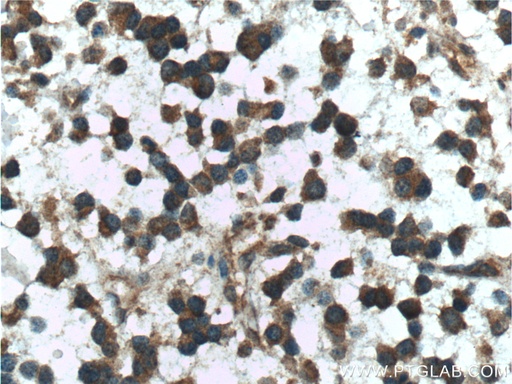 [16163-1-AP-150UL] Presenilin-1-Specific Polyclonal antibody