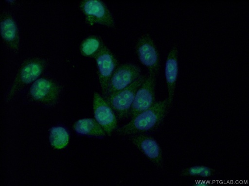[16166-1-AP-150UL] HDAC5-specific Polyclonal antibody