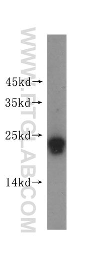 [16181-1-AP-150UL] RAB22A-specific Polyclonal antibody