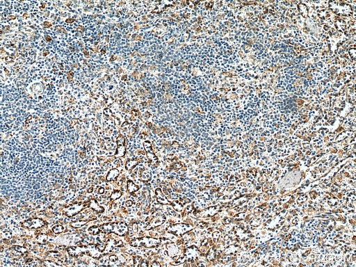 [16190-1-AP-20UL] FcRn-Specific Polyclonal antibody