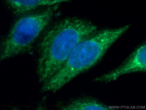 [16200-1-AP-20UL] ALAS1 Polyclonal antibody