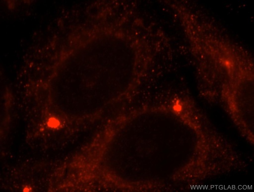 [16215-1-AP-150UL] ACAT1 Polyclonal antibody
