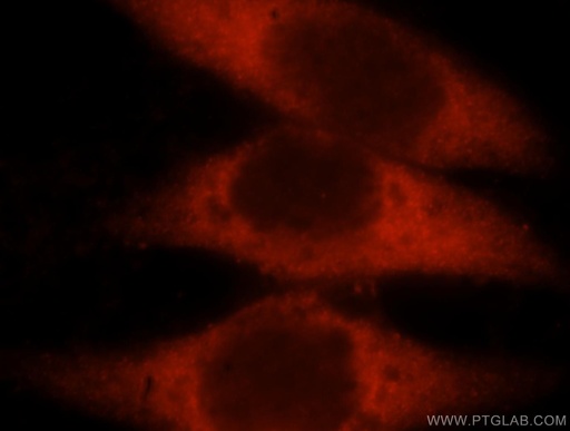 [16221-1-AP-20UL] LDHAL6A Polyclonal antibody