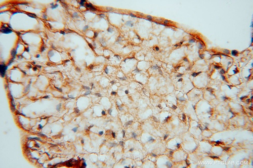 [16228-1-AP-20UL] KDSR Polyclonal antibody