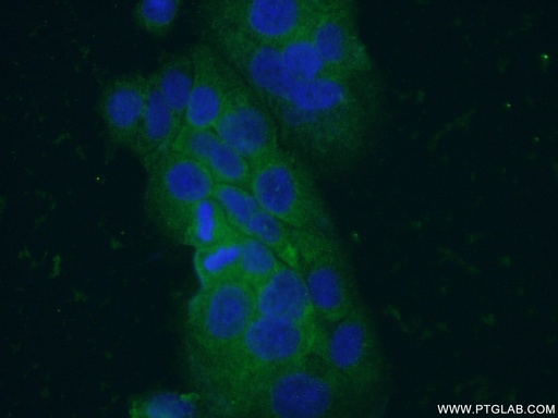 [16233-1-AP-20UL] VIP Polyclonal antibody