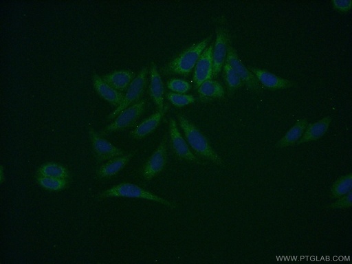 [16242-1-AP-20UL] SDSL Polyclonal antibody