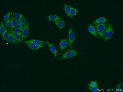 [16244-1-AP-150UL] ATP13A1 Polyclonal antibody
