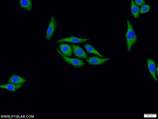 [16251-1-AP-20UL] FAF2 Polyclonal antibody