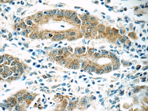 [16254-1-AP-150UL] MRPL1 Polyclonal antibody