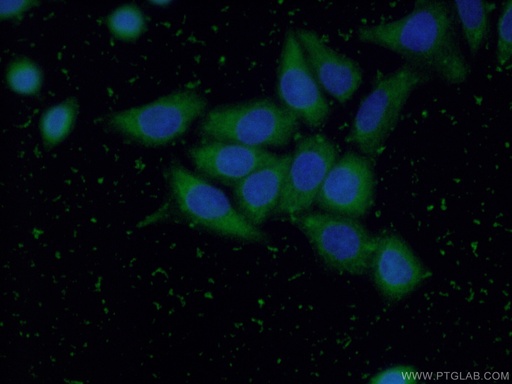 [16257-1-AP-20UL] GGCT Polyclonal antibody