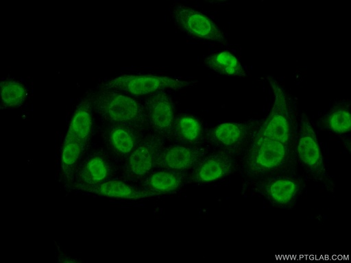 [16264-1-AP-150UL] PQBP1 Polyclonal antibody