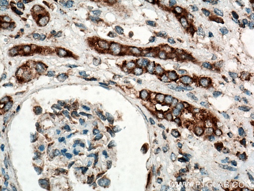 [16275-1-AP-20UL] DHRS1 Polyclonal antibody