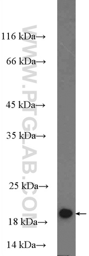 [16299-1-AP-20UL] MRPL22 Polyclonal antibody