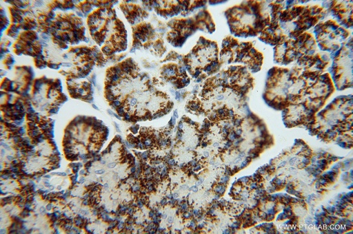 [16317-1-AP-150UL] GCAT Polyclonal antibody