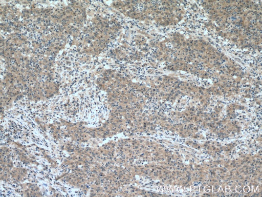 [16321-1-AP-150UL] BACE2 Polyclonal antibody