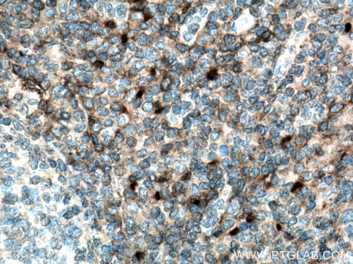 [16337-1-AP-150UL] CD157 Polyclonal antibody