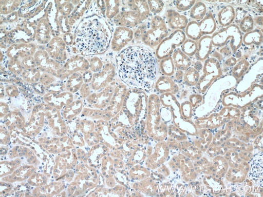 [16338-1-AP-20UL] ABP1 Polyclonal antibody