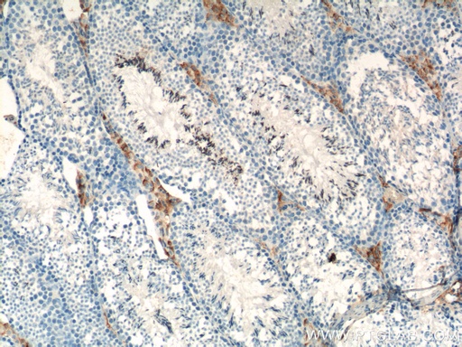 [16342-1-AP-150UL] SLC35A1 Polyclonal antibody