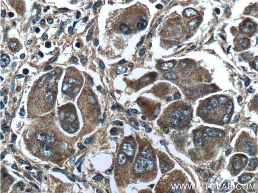 [16347-1-AP-150UL] PAH Polyclonal antibody