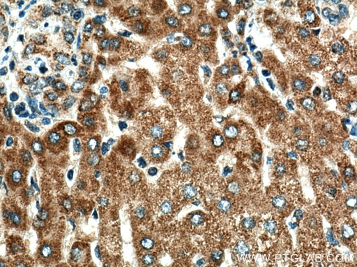[16360-1-AP-20UL] TXNRD2 Polyclonal antibody