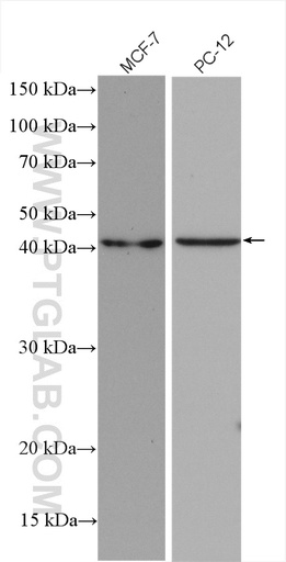 [16366-1-AP-150UL] SHOX2 Polyclonal antibody