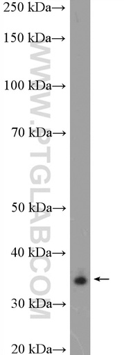 [16372-1-AP-150UL] ALX1 Polyclonal antibody