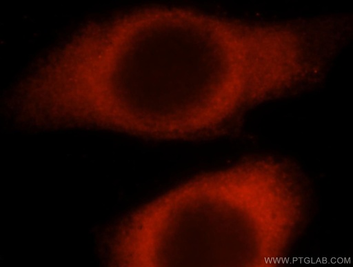 [16375-1-AP-20UL] HARS Polyclonal antibody