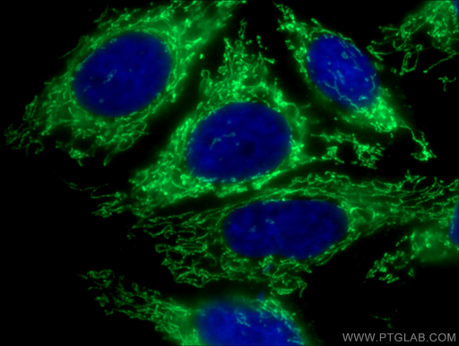 [16378-1-AP-20UL] MRPS28 Polyclonal antibody